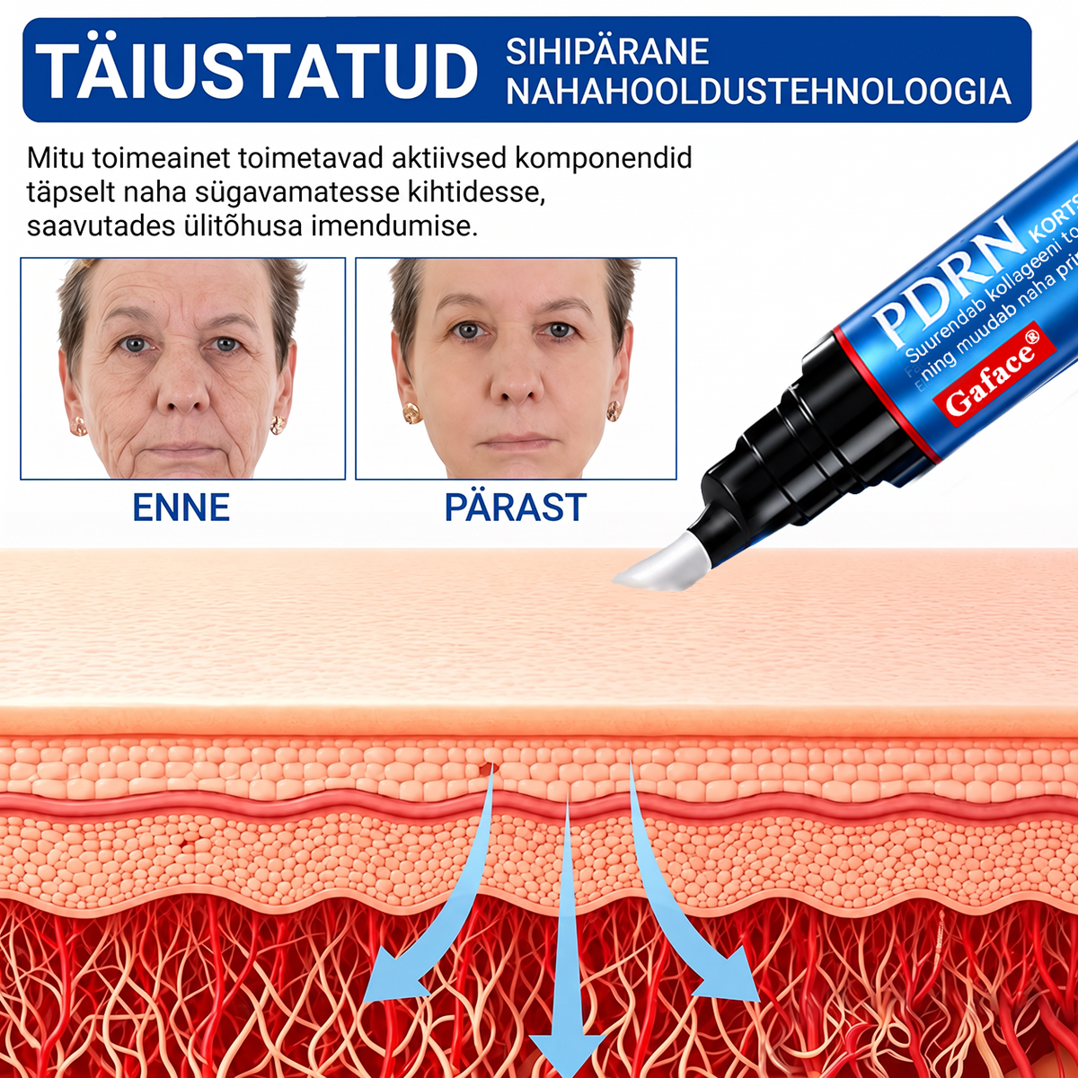 𝑮𝒂𝒇𝒂𝒄𝒆® 👩‍⚕️✨ 𝑃𝐷𝑅𝑁 KORTSEID SILUV JA PINGULDAV KREEM