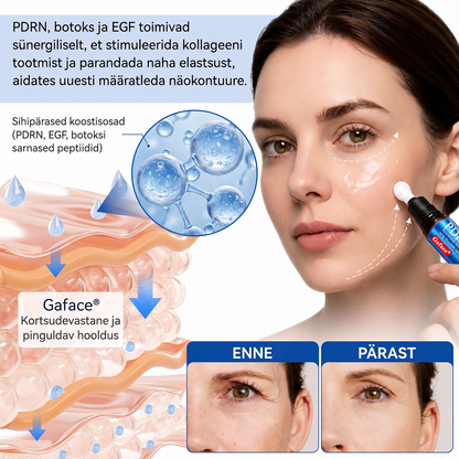 𝑮𝒂𝒇𝒂𝒄𝒆® 👩‍⚕️✨ 𝑃𝐷𝑅𝑁 KORTSEID SILUV JA PINGULDAV KREEM