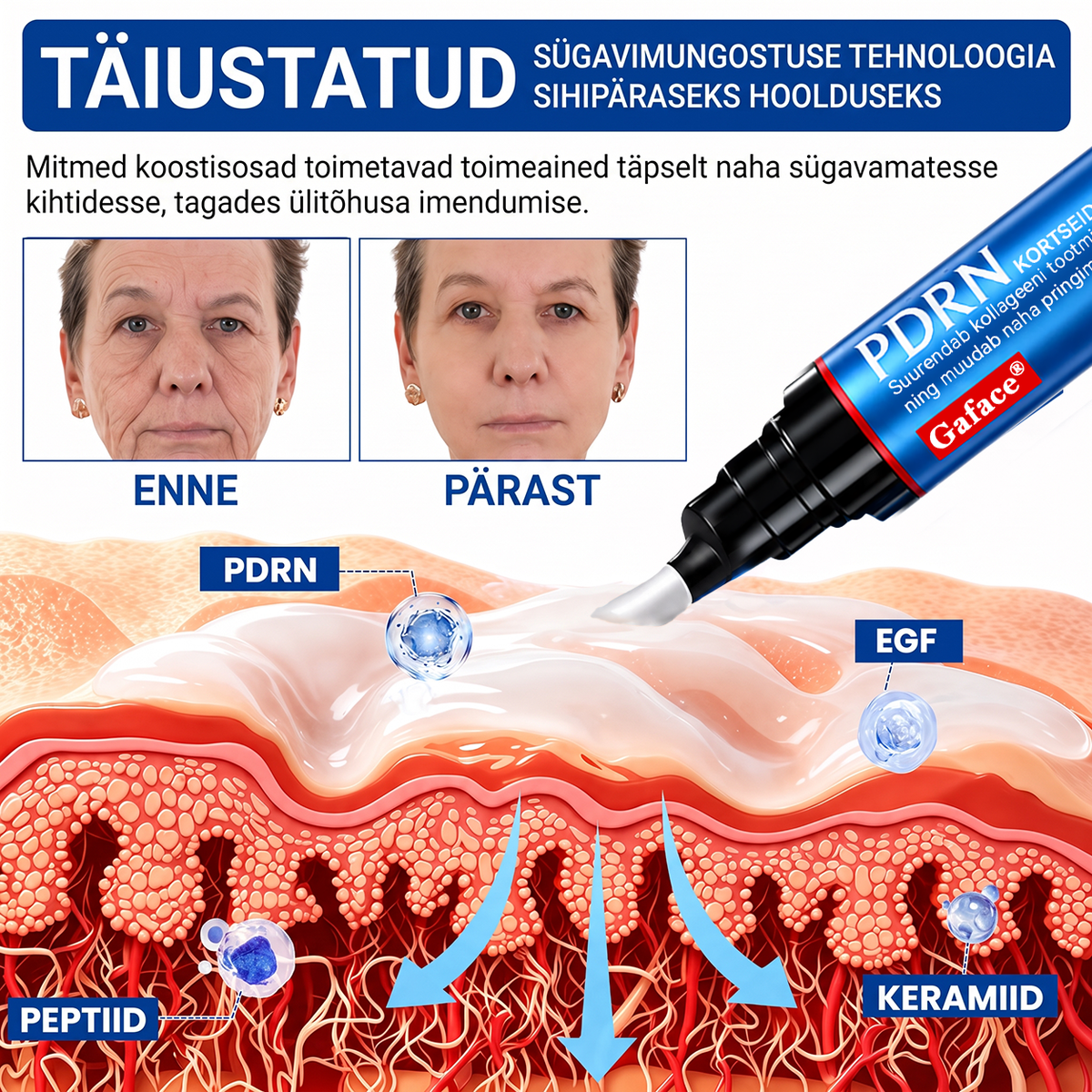 𝑮𝒂𝒇𝒂𝒄𝒆® 👩‍⚕️✨ 𝑃𝐷𝑅𝑁 KORTSEID SILUV JA PINGULDAV KREEM