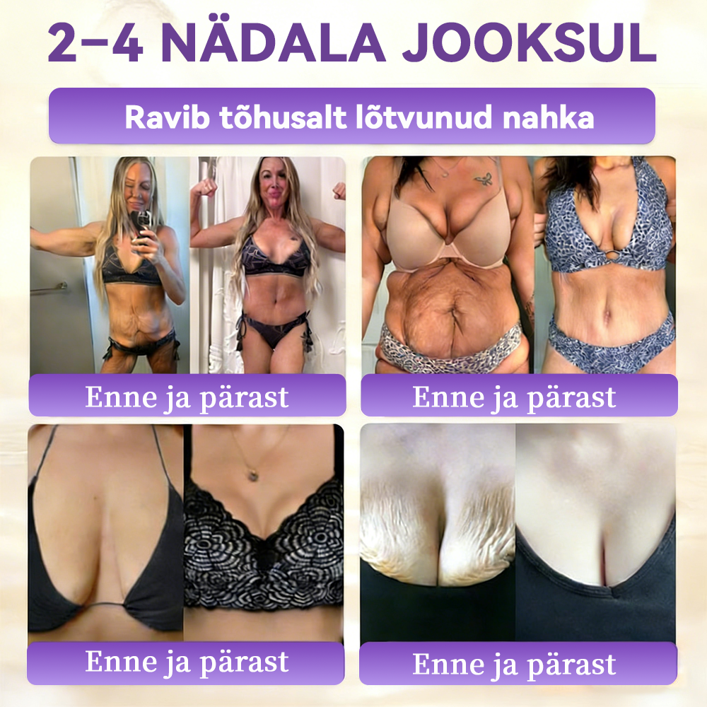 Valmistatud ja saadetud Eestist ⭐𝑭𝒍𝒐𝒓𝒊𝒔𝒎𝒂® 𝑩𝒊𝒐𝒕𝒊𝒊𝒏 10-Ü𝒉𝒆𝒔 𝑵𝒂𝒉𝒌 𝑻𝒂𝒂𝒔𝒕𝒂𝒎𝒊𝒏𝒆 𝑲𝒓𝒆𝒆𝒎 🍀