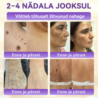 Valmistatud ja saadetud Eestist ⭐𝑭𝒍𝒐𝒓𝒊𝒔𝒎𝒂® 𝑩𝒊𝒐𝒕𝒊𝒊𝒏 10-Ü𝒉𝒆𝒔 𝑵𝒂𝒉𝒌 𝑻𝒂𝒂𝒔𝒕𝒂𝒎𝒊𝒏𝒆 𝑲𝒓𝒆𝒆𝒎 🍀