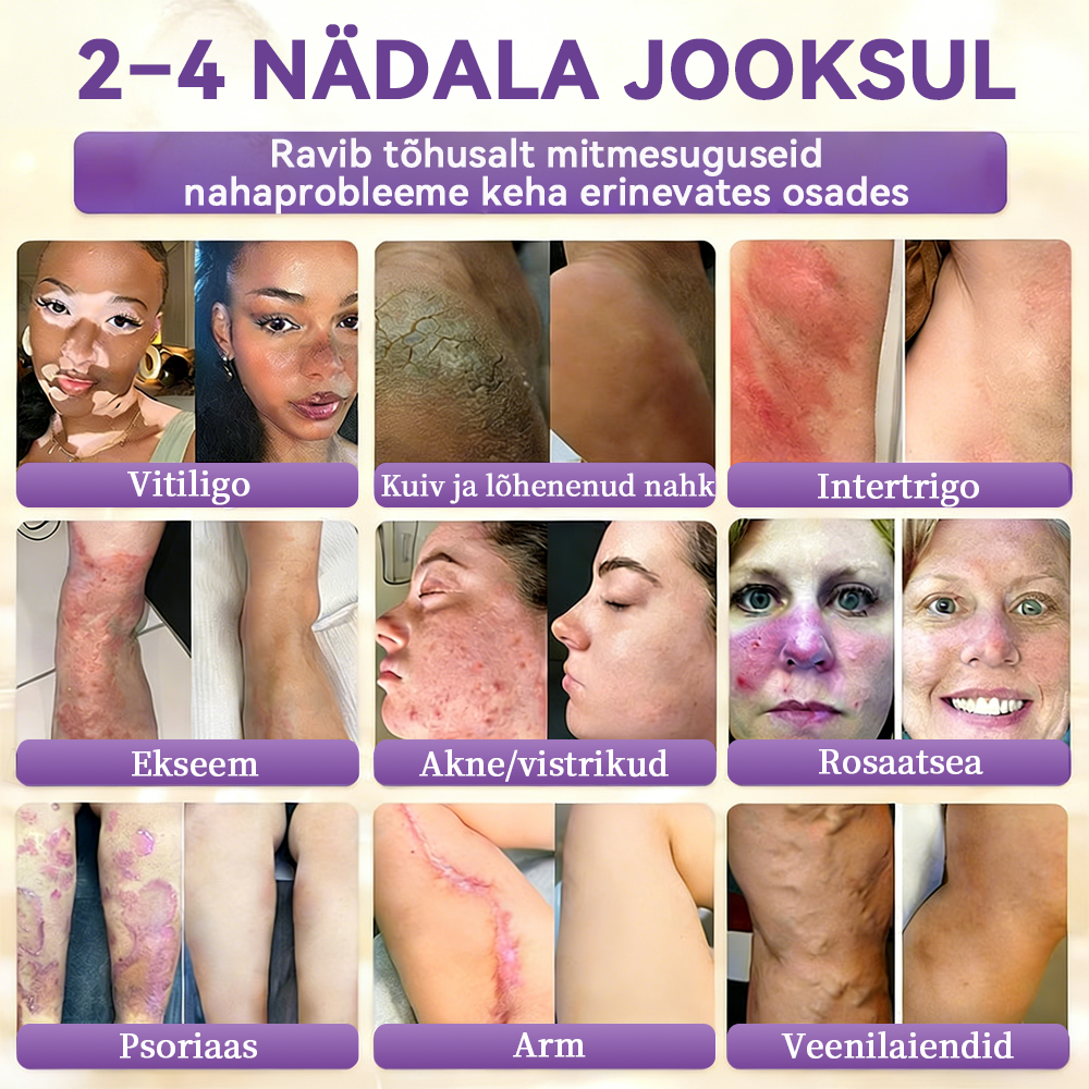 Valmistatud ja saadetud Eestist ⭐𝑭𝒍𝒐𝒓𝒊𝒔𝒎𝒂® 𝑩𝒊𝒐𝒕𝒊𝒊𝒏 10-Ü𝒉𝒆𝒔 𝑵𝒂𝒉𝒌 𝑻𝒂𝒂𝒔𝒕𝒂𝒎𝒊𝒏𝒆 𝑲𝒓𝒆𝒆𝒎 🍀