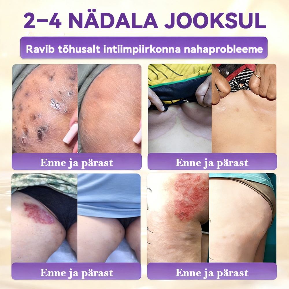 Valmistatud ja saadetud Eestist ⭐𝑭𝒍𝒐𝒓𝒊𝒔𝒎𝒂® 𝑩𝒊𝒐𝒕𝒊𝒊𝒏 10-Ü𝒉𝒆𝒔 𝑵𝒂𝒉𝒌 𝑻𝒂𝒂𝒔𝒕𝒂𝒎𝒊𝒏𝒆 𝑲𝒓𝒆𝒆𝒎 🍀