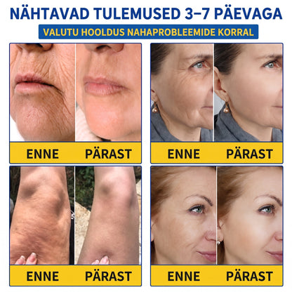 𝑮𝒂𝒇𝒂𝒄𝒆® 👩‍⚕️✨ 𝑃𝐷𝑅𝑁 KORTSEID SILUV JA PINGULDAV KREEM