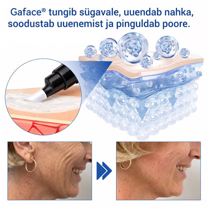𝑮𝒂𝒇𝒂𝒄𝒆® 👩‍⚕️✨ 𝑃𝐷𝑅𝑁 KORTSEID SILUV JA PINGULDAV KREEM
