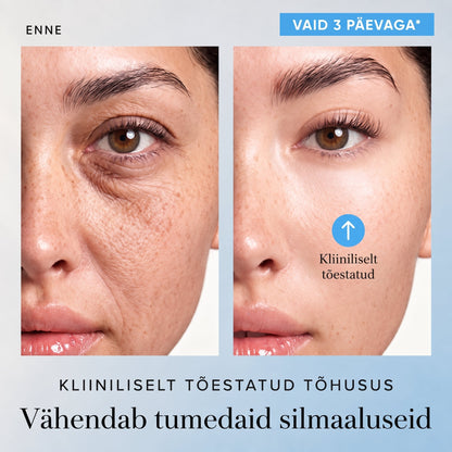 𝑮𝒂𝒇𝒂𝒄𝒆® 👩‍⚕️✨ 𝑃𝐷𝑅𝑁 KORTSEID SILUV JA PINGULDAV KREEM