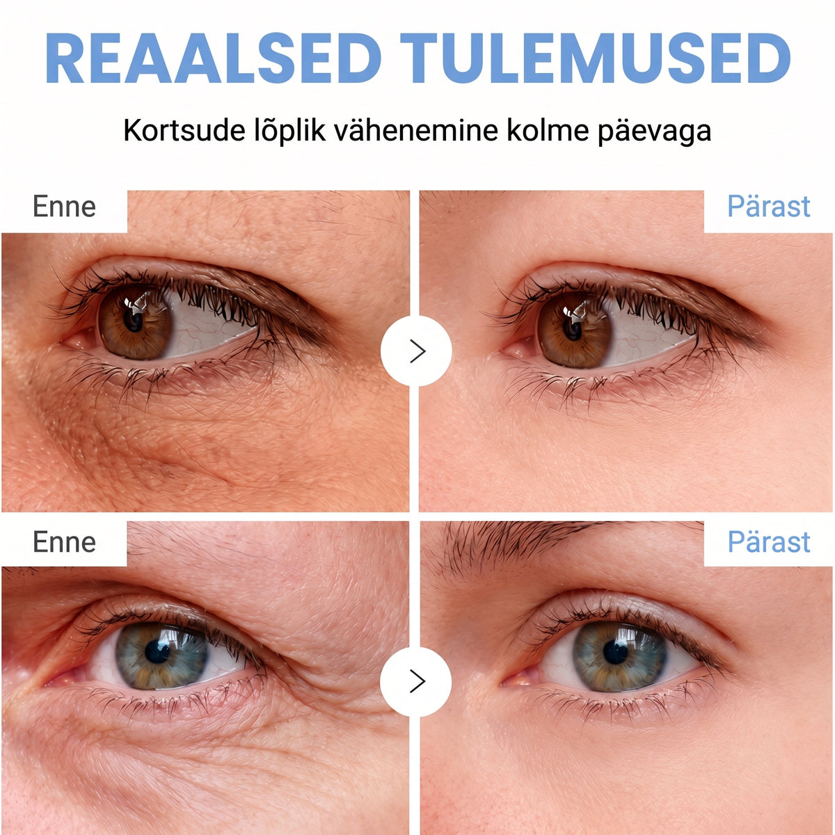 𝑮𝒂𝒇𝒂𝒄𝒆® 👩‍⚕️✨ 𝑃𝐷𝑅𝑁 KORTSEID SILUV JA PINGULDAV KREEM