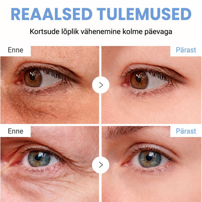 𝑮𝒂𝒇𝒂𝒄𝒆® 👩‍⚕️✨ 𝑃𝐷𝑅𝑁 KORTSEID SILUV JA PINGULDAV KREEM