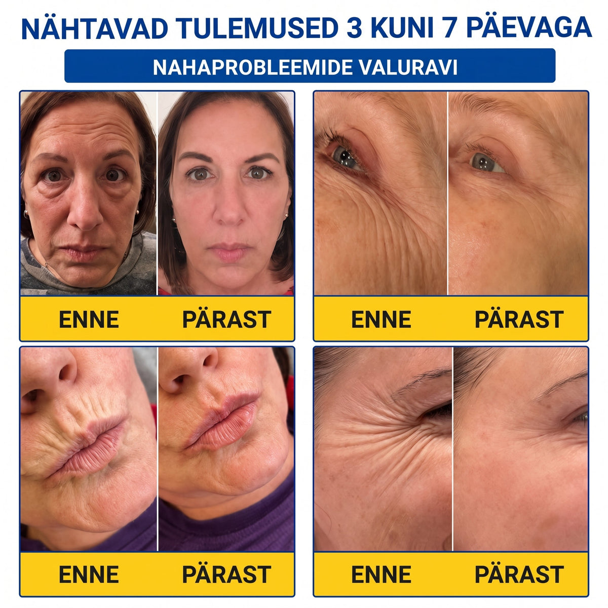 𝑮𝒂𝒇𝒂𝒄𝒆® 👩‍⚕️✨ 𝑃𝐷𝑅𝑁 KORTSEID SILUV JA PINGULDAV KREEM