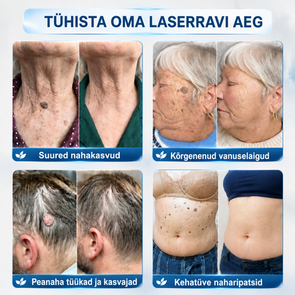 👩🏻‍⚕️🎁𝐏𝐢𝐜𝐝𝐨® 7-𝒑ä𝒆𝒗 𝑷𝒍𝒆𝒌𝒊𝒆𝒆𝒎𝒂𝒍𝒅𝒖𝒔 𝑨𝒓𝒎𝒊𝒅𝒆 𝒗ä𝒉𝒆𝒏𝒅𝒂𝒎𝒊𝒏𝒆 𝑷𝒍𝒊𝒊𝒂𝒕𝒔(Zero Pain, Zero Scars rullik)