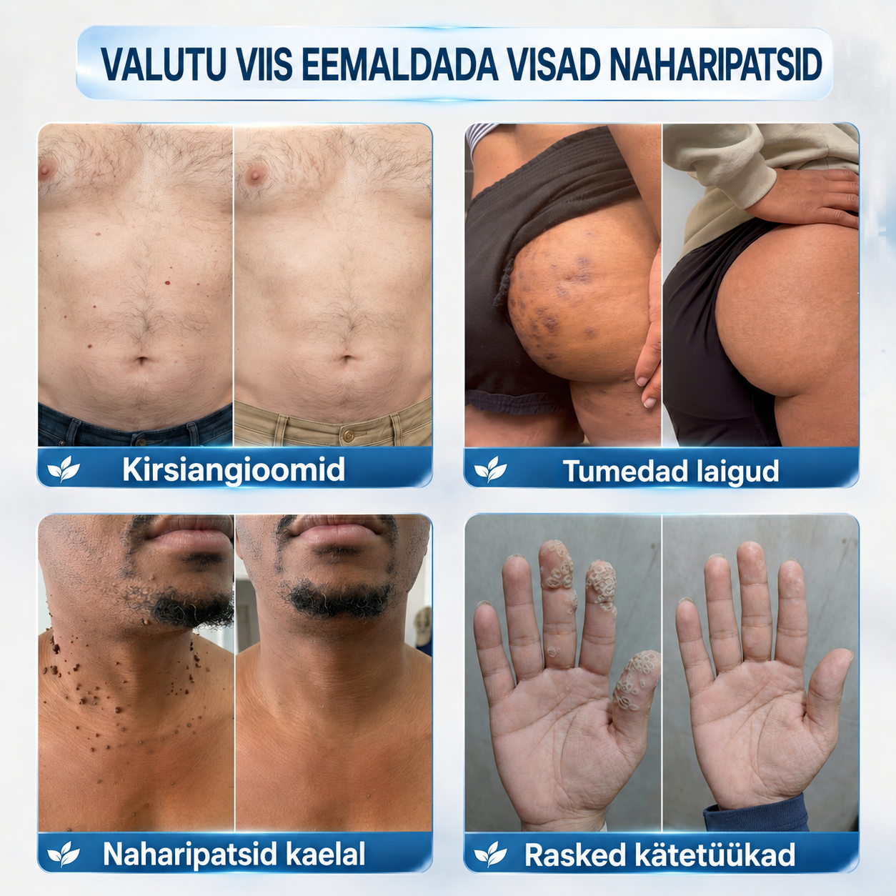 👩🏻‍⚕️🎁𝐏𝐢𝐜𝐝𝐨® 7-𝒑ä𝒆𝒗 𝑷𝒍𝒆𝒌𝒊𝒆𝒆𝒎𝒂𝒍𝒅𝒖𝒔 𝑨𝒓𝒎𝒊𝒅𝒆 𝒗ä𝒉𝒆𝒏𝒅𝒂𝒎𝒊𝒏𝒆 𝑷𝒍𝒊𝒊𝒂𝒕𝒔(Zero Pain, Zero Scars rullik)