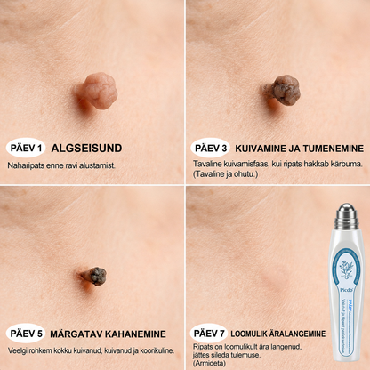 👩🏻‍⚕️🎁𝐏𝐢𝐜𝐝𝐨® 7-𝒑ä𝒆𝒗 𝑷𝒍𝒆𝒌𝒊𝒆𝒆𝒎𝒂𝒍𝒅𝒖𝒔 𝑨𝒓𝒎𝒊𝒅𝒆 𝒗ä𝒉𝒆𝒏𝒅𝒂𝒎𝒊𝒏𝒆 𝑷𝒍𝒊𝒊𝒂𝒕𝒔(Zero Pain, Zero Scars rullik)