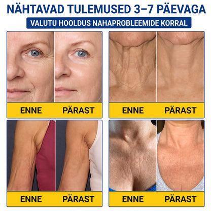 𝑮𝒂𝒇𝒂𝒄𝒆® 👩‍⚕️✨ 𝑃𝐷𝑅𝑁 KORTSEID SILUV JA PINGULDAV KREEM