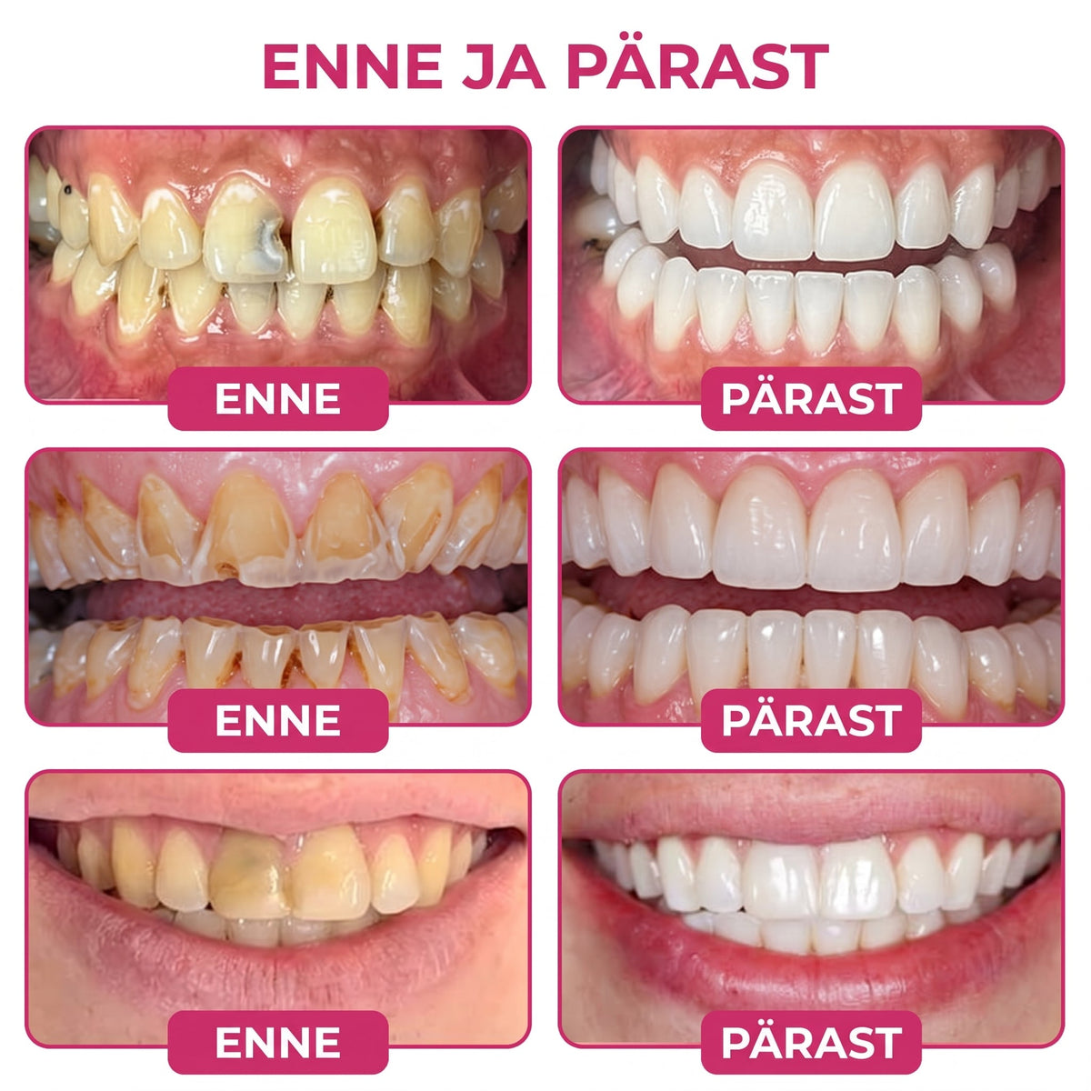 𝐾𝑒𝑦𝑒𝑠𝑠® 𝐷𝑒𝑛𝑃𝑒𝑟𝑚🍟🍟🎉 — 𝐾𝑎𝑎𝑟𝑖𝑒𝑠𝑒 𝑝𝑎𝑟𝑎𝑛𝑑𝑎𝑚𝑖𝑛𝑒 𝐿𝑜𝑜𝑑𝑠𝑙𝑖𝑘 𝑒𝑚𝑎𝑖𝑙𝑙 𝑡𝑎𝑖𝑡𝑒𝑔𝑒𝑒𝑙, 𝑇𝑢𝑛𝑑𝑙𝑖𝑘𝑢𝑑 ℎ𝑎𝑚𝑏𝑎𝑑 𝑗𝑎 𝑛õ𝑟𝑔𝑒𝑛𝑒𝑛𝑢𝑑 ℎ𝑎𝑚𝑏𝑎𝑒𝑚𝑎𝑖𝑙
